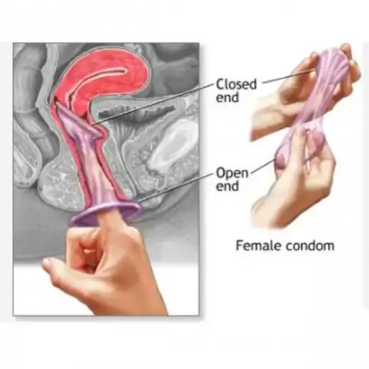 Female Condom Sex Solution Stimulation